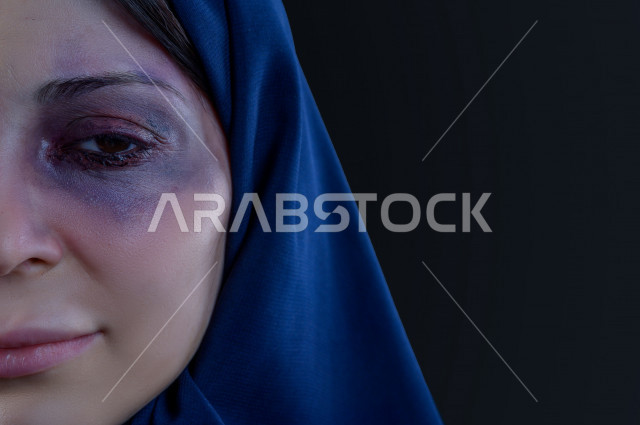 Expressions and emoticons of the face and hands of a Saudi woman subjected to physical violence, stop violence against women, end violence against women, November 25, International Day for the Elimination of Violence Against Women, physical bruising