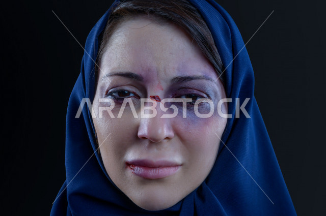 تعابير و ايمياءات وجه و يدين لمرأة سعودية تتعرض للعنف الجسدي ، اوقفو العنف ضد المرأه ، انهاء العنف ضد النساء ، 25 نوفمبراليوم العالمي للقضاء على العنف ضد النساء ، كدمات جسدية 