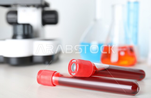 صورة مقربة لأنابيب زجاجية مليئة بالدم داخل المختبرات الطبية،اجراء التحاليل الدموية، مفهوم الكيمياء الحيوية, التفاعلات الكيميائية الفعالة، مفهوم الطب والرعاية الصحيه