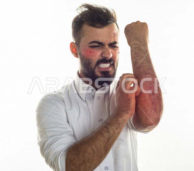  بورتريه لرجل سعودي خليجي مصاب بعدة مشاكل في منطقة الوجه، التعرض للحروق ،  حب شباب منتشرة على البشرة ، ايماءات و تعبيرات وجه و يدين تدل على الآلم و الحزن ، مشاكل صحية و اصابات جسدية ، خلفية بيضاء