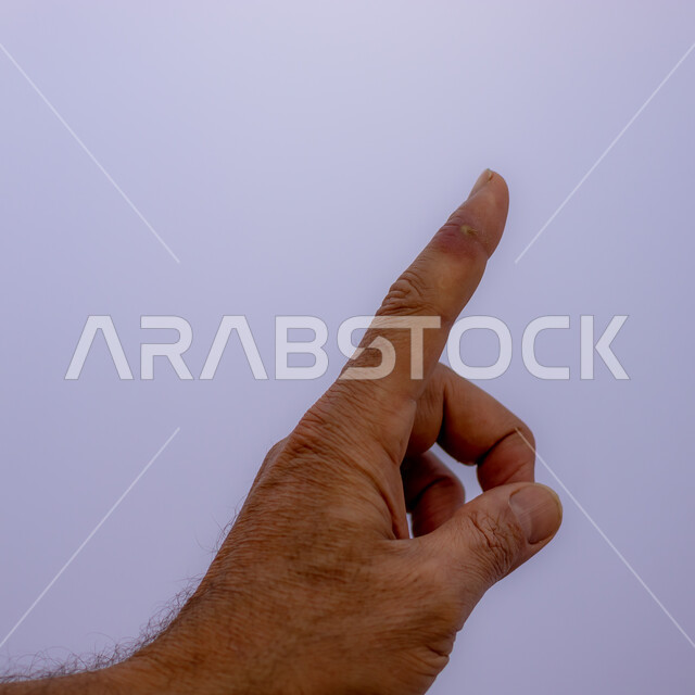 The necessity of visiting a dermatologist for treatment and surgery, the results of minor injuries and acupuncture, human skin diseases, a close-up image of the hand of a Saudi Arabian Gulf man with an abscess on his finger, collection of pus in the skin and subcutaneous tissue