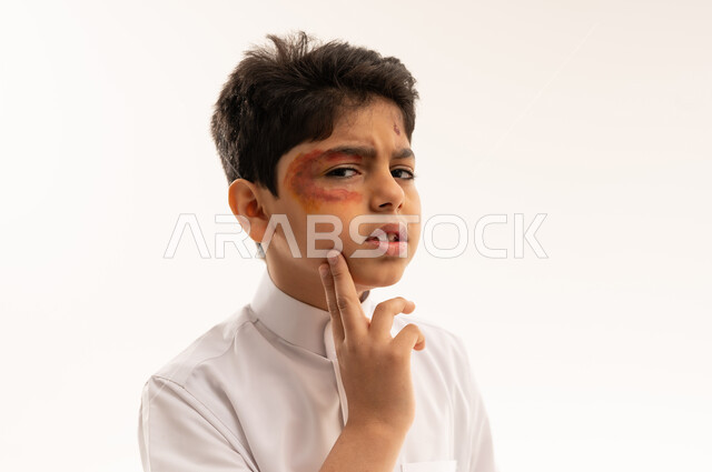 Injured Saudi Boy with Bruised Eye on White Background