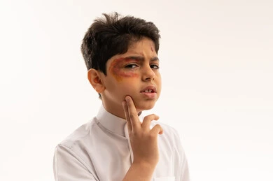 Injured Saudi Boy with Bruised Eye on White Background