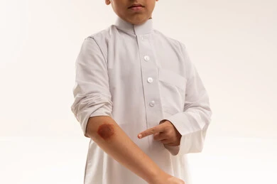 Saudi Boy Pointing at Skin Lesion on Elbow Studio Shot