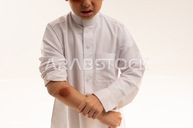 Saudi Boy with Bruised Arm Injury in White Thobe