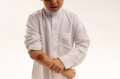 طفل سعودي مصاب بكدمة في الذراع بالثوب الأبيض