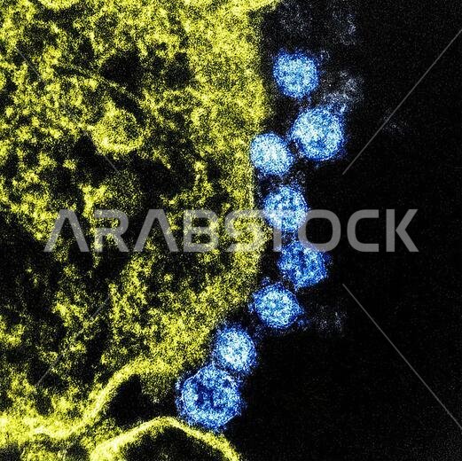 MERS Coronavirus. Middle East Respiratory Syndrome (MERS) is viral respiratory illness that is new to humans. It was first reported in Saudi Arabia in 2012 and has since spread to several other countries, including the United States. Most people infected with MERS-CoV developed severe respiratory illness, including fever, cough, and shortness of breath. Many of them have died.