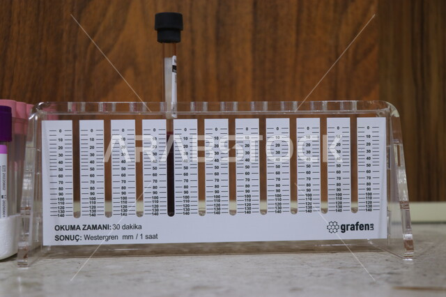 إستخدام انابيب الاختبار لإجراء التجارب في المخبر ، إجراء تجارب وتفاعلات كيميائية في المختبر، تجارب وأبحاث علمية ، مختبر ومعمل الكيمياء، البحث والتطوير ، إستخدام انابيب الاختبار لإجراء التجارب