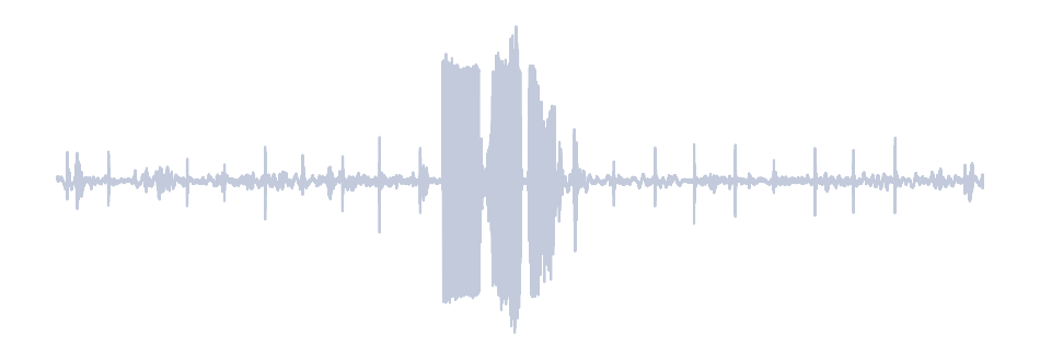Gray Waveform