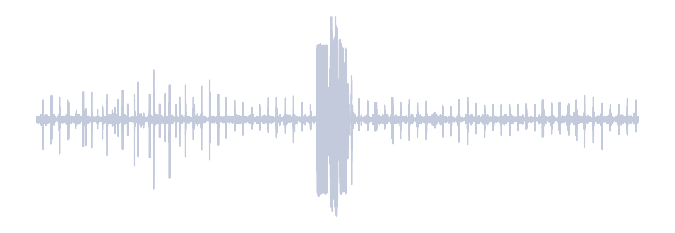 Gray Waveform