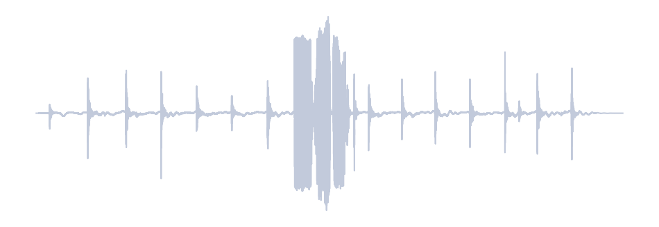 Gray Waveform