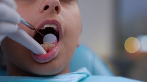 الادوات اللازمة لإجراء الفحوصات، معالجة النخر والتسوس, تصوير مقرب لولد عربي خليجي عماني يرتدي الزي التقليدي يجلس في العيادة السنية ويفتح فمه لتشخيص المرض ، ايدي طبيب عربي خليجي عماني يرتدي القفازات الطبية يقوم بفحص أسنان المريض