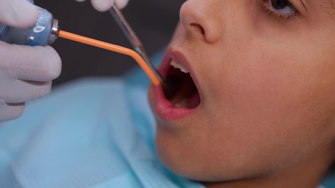 الحصول على ابتسامة مثالية، الادوات اللازمة لإجراء الفحوصات، معالجة النخر والتسوس, تصوير مقرب لولد عربي خليجي عماني يرتدي الزي التقليدي يجلس في العيادة السنية ويفتح فمه لتشخيص المرض, ايدي طبيب عربي خليجي عماني يرتدي القفازات الطبية يقوم بفحص أسنان المريض