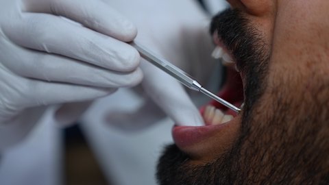 شاب عربي خليجي عماني يرتدي الزي التقليدي يجلس على كرسي العلاج، زيارة العيادة السنية لإجراء الفحوصات الدورية، تصوير مقرب لطبيب يرتدي القفازات الطبية يقوم بفحص أسنان المريض وتشخيص المرض, العناية بالصحة الفموية، تركيب الحشوات ومعالجة التسوس، المعدات اللازمة لإجراء الفحوصات الطبية