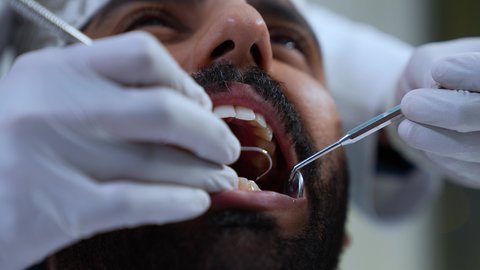 شاب عربي خليجي عماني يرتدي الزي التقليدي يجلس على كرسي العلاج، تصوير مقرب لطبيب يرتدي القفازات الطبية يقوم بفحص أسنان المريض وتشخيص المرض, العناية بالصحة الفموية، تركيب الحشوات ومعالجة التسوس، زيارة العيادة السنية لإجراء الفحوصات الدورية