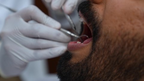 العناية بالصحة الفموية، تركيب الحشوات ومعالجة التسوس، زيارة العيادة السنية لإجراء الفحوصات الدورية، تصوير مقرب لطبيب يرتدي القفازات الطبية يقوم بفحص أسنان المريض وتشخيص المرض, شاب عربي خليجي عماني يرتدي الزي التقليدي يجلس على كرسي العلاج