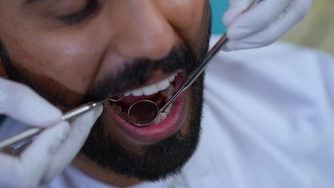 زيارة العيادة السنية لإجراء الفحوصات الدورية، تركيب الحشوات ومعالجة التسوس، العناية بالصحة الفموية، تصوير مقرب لطبيب يرتدي القفازات الطبية يقوم بفحص أسنان المريض وتشخيص المرض, شاب عربي خليجي عماني يرتدي الزي التقليدي يجلس على كرسي العلاج