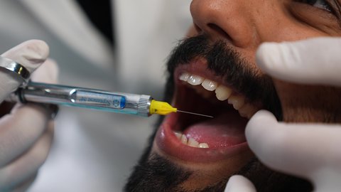 الاستعداد لحقن البنج الموضعي لتخفيف الشعور بالألم ,تقديم الرعاية الصحية في المراكز التخصصية، تصوير مقرب لرجل عربي خليجي عماني يرتدي الزي التقليدي يجلس في العيادة السنية بإيماءات السرور, يد طبيب أسنان يرتدي القفازات الطبية يمسك بيده إبرة المخدر،معالجة النخور والتسوس