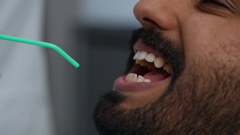 تصوير مقرب لطبيب يرتدي القفازات يقوم بفحص أسنان المريض، مفهوم الطب والرعاية الصحية، العناية بالصحة الفموية، استخدام الأدوات المعقمة لإجراء الفحوصات السنية، تقديم الخدمات الطبية للمرضى, شاب عربي خليجي عماني يرتدي الزي التقليدي يجلس على كرسي العلاج