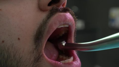 استخدام المعدات اللازمة فى الجراحة , معالجة النخور وتركيب الحشوات، الزيارة الدورية للاطمئنان على الصحة الفموية، تصوير مقرب من الجانب لطبيب يرتدي القفازات يقوم بفحص أسنان المريض وتشخيص المرض، شاب عربي خليجي عماني يرتدي الدشداشة والكمة يجلس على كرسي العلاج في العيادة السنية