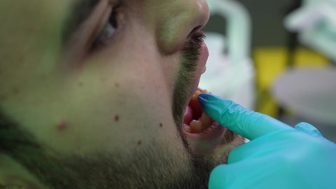 تقديم الخدمات الطبية للمرضى ، إجراء الفحوصات الدورية للعناية بالصحة الفموية، مفهوم الطب والرعاية الصحية، تصوير مقرب من الجانب لطبيب يرتدي القفازات يقوم بفحص أسنان المريض، شاب عربي خليجي عماني يرتدي الدشداشة والكمة يجلس على كرسي العلاج في العيادة السنية