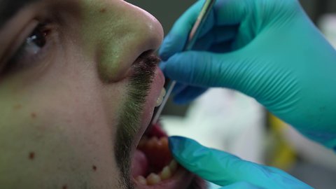 إجراء الفحوصات الدورية للعناية بالصحة الفموية، مفهوم الطب والرعاية الصحية، تصوير مقرب من الجانب لطبيب يرتدي القفازات يقوم بفحص أسنان المريض، شاب عربي خليجي عماني يرتدي الدشداشة والكمة يجلس على كرسي العلاج في العيادة السنية، تقديم الخدمات الطبية للمرضى