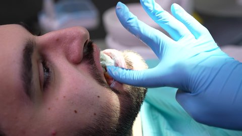 شاب عربي خليجي عماني يرتدي الدشداشة والكمة يجلس على كرسي العلاج في العيادة السنية، مفهوم الطب والرعاية الصحية، تصوير مقرب من الجانب لطبيب يرتدي القفازات يقوم بفحص أسنان المريض، تقديم الخدمات الطبية للمرضى ، إجراء الفحوصات الدورية للعناية بالصحة الفموية