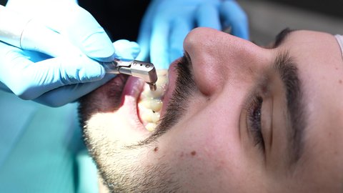 شاب عربي خليجي عماني يرتدي الدشداشة والكمة يجلس على كرسي العلاج في العيادة السنية، إجراء الفحوصات الدورية للعناية بالصحة الفموية، تقديم الخدمات الطبية للمرضى,مفهوم الطب والرعاية الصحية، تصوير مقرب من الجانب لطبيب يرتدي القفازات يقوم بفحص أسنان المريض