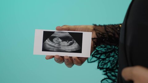 مفهوم الحمل والأمومة، تصوير مقرب ليد امراه عربيه خليجيه سعودية ترتدي العباءة السوداء تقوم بعرض صورة أشعة لجنين، التشخيص الطبي عبر الأشعة الصوتية، متابعة الحمل عبر صورة السونار