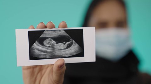 متابعة الحمل عبر صورة السونار، التشخيص الطبي عبر الأشعة الصوتية، مفهوم الحمل والأمومة، تصوير مقرب ليد امراه عربيه خليجيه سعودية محجبه ترتدي العباءة السوداء و الكمامة تقوم بعرض صورة أشعة لجنين، الوقاية من فايروس كورونا ، خلفية خضراء